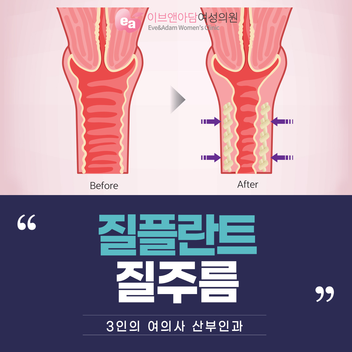 생활습관개선